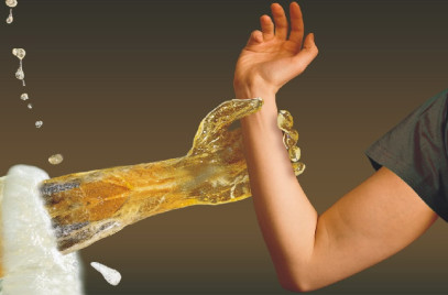 Пивной алкоголизм